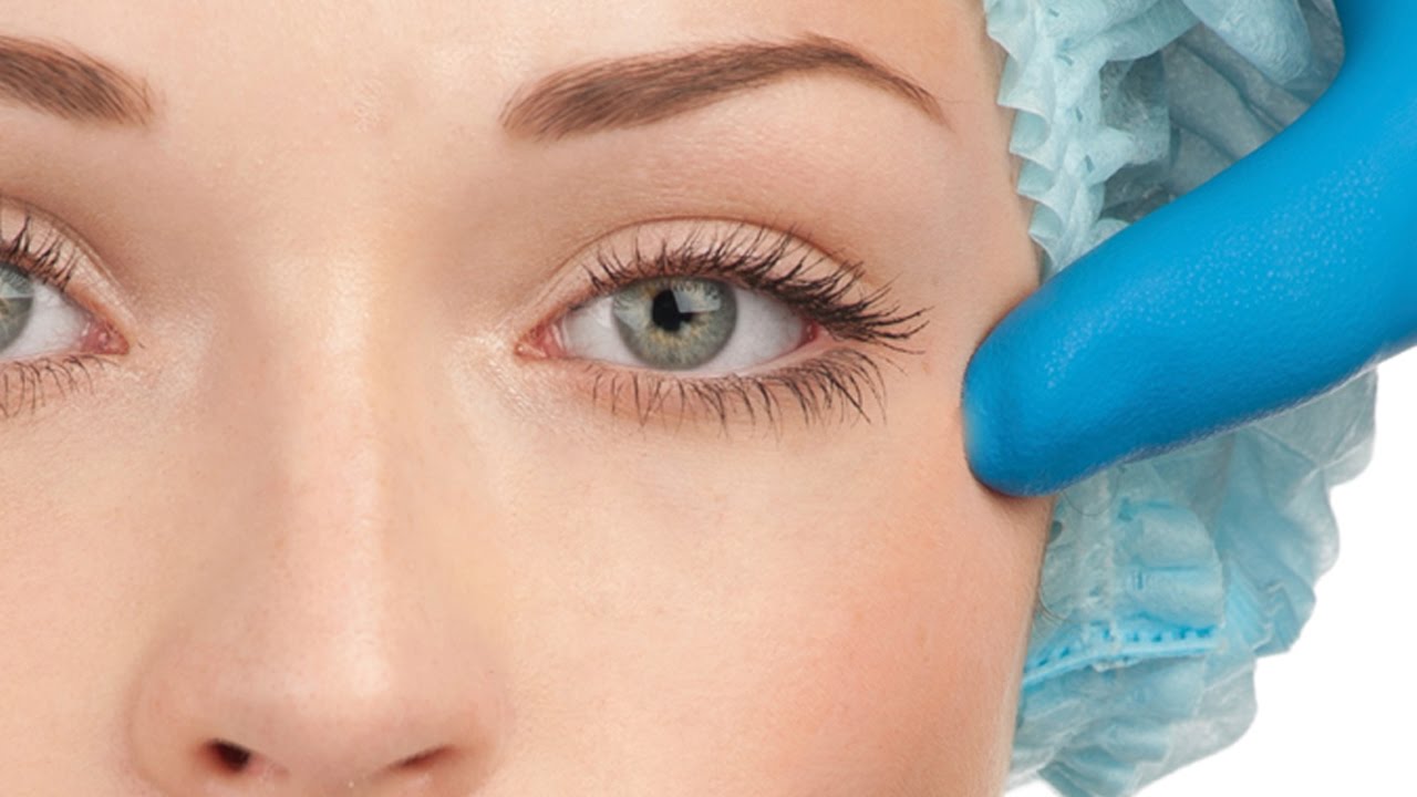 Göz Kapağı Estetiği Öncesi