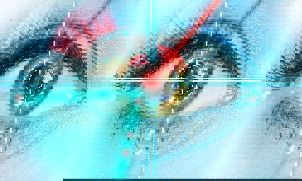 No Touch Lazer Kimlere Yapılır